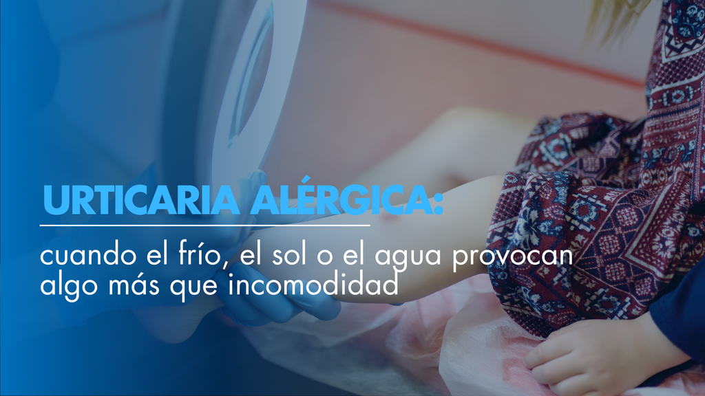 Urticaria alérgica: cuando el frío, el sol o el agua provocan algo más que incomodidad
